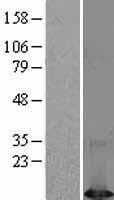 DYNLT1 Human Over-expression Lysate