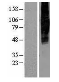 SLC34A2 Human Over-expression Lysate