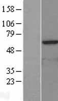 KAT5 Human Over-expression Lysate