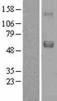 SRPX Human Over-expression Lysate