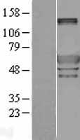 Peripherin (PRPH) Human Over-expression Lysate