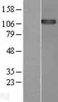 ENPP1 Human Over-expression Lysate