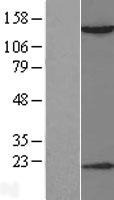 HDAC6 Human Over-expression Lysate