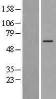 FOXO4 Human Over-expression Lysate