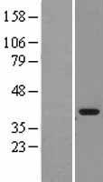 MDH1 Human Over-expression Lysate