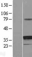 HSD11B1 Human Over-expression Lysate