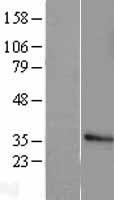 Histone H1.2 (HIST1H1C) Human Over-expression Lysate