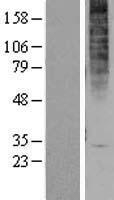 CMKLR2 Human Over-expression Lysate