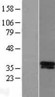 DLX5 Human Over-expression Lysate