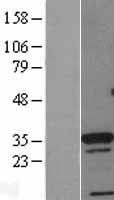 CDX4 Human Over-expression Lysate