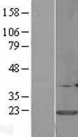 CALM3 Human Over-expression Lysate