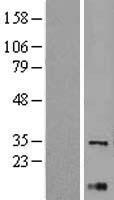 XBP1 Human Over-expression Lysate