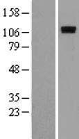 ROR1 Human Over-expression Lysate