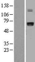 ALS (IGFALS) Human Over-expression Lysate