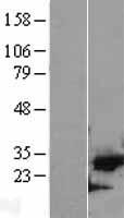 CDK5 Human Over-expression Lysate