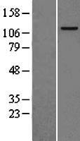 MCM2 Human Over-expression Lysate