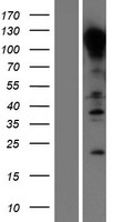E Cadherin (CDH1) Human Over-expression Lysate