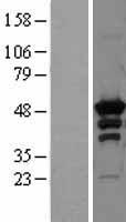 PKA R2 (PRKAR2A) Human Over-expression Lysate
