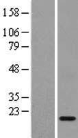 Adrenodoxin (FDX1) Human Over-expression Lysate