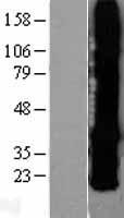 GJB2 Human Over-expression Lysate