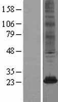 NAT8 Human Over-expression Lysate