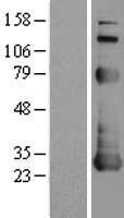 Apoptosis repressor with CARD (NOL3) Human Over-expression Lysate