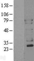 N WASP (WASL) Human Over-expression Lysate