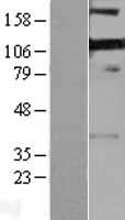 RIL (PDLIM4) Human Over-expression Lysate