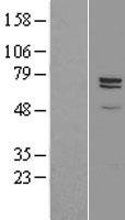 Carboxypeptidase Z (CPZ) Human Over-expression Lysate
