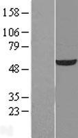 UDP glucose dehydrogenase (UGDH) Human Over-expression Lysate