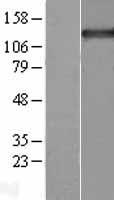 Tripeptidyl peptidase II (TPP2) Human Over-expression Lysate
