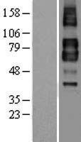 TGF beta Receptor II (TGFBR2) Human Over-expression Lysate