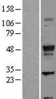 TGF beta 2 (TGFB2) Human Over-expression Lysate