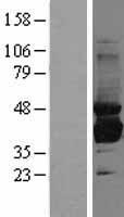 Sorbitol Dehydrogenase (SORD) Human Over-expression Lysate