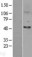 Fascin (FSCN1) Human Over-expression Lysate