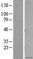 CXCL5 Human Over-expression Lysate