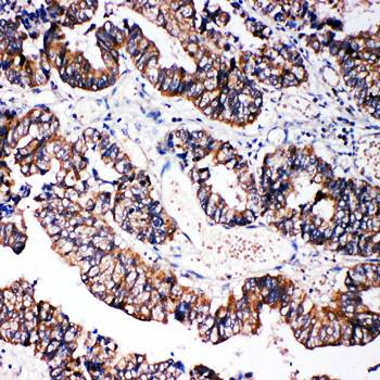 Anti-Caspase-3 (P10)/CASP3 Antibody