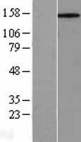 CD45 (PTPRC) Human Over-expression Lysate