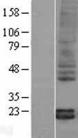 Pleiotrophin (PTN) Human Over-expression Lysate