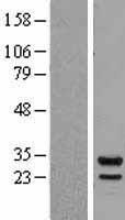 Proteasome 20S beta 7 (PSMB7) Human Over-expression Lysate
