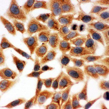 Anti-HSD17B1 Antibody