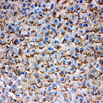 Anti-HSD17B1 Antibody