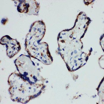 Anti-HSD17B1 Antibody