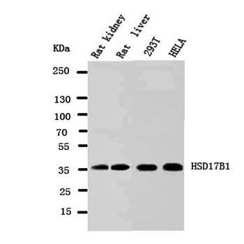 Anti-HSD17B1 Antibody