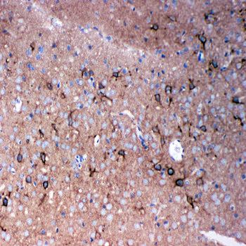 Anti-Tenascin-R TNR Antibody