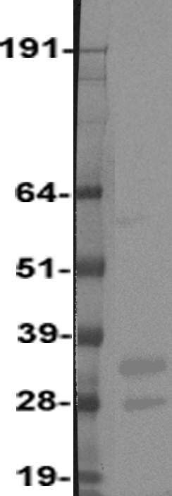 PDGF beta (PDGFB) Human Over-expression Lysate