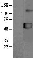 P2X5 (P2RX5) Human Over-expression Lysate