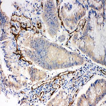 CD31/PECAM1 Antibody