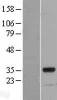 MYF6 Human Over-expression Lysate