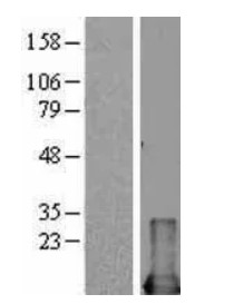 MIF Human Over-expression Lysate